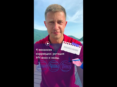 Видео: 7. 4-й механизм коррекции:  ротация НЧ вниз и назад. | #конспектсеминара