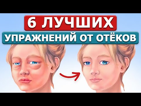 Видео: Как убрать ОТЁКИ с ГЛАЗ и ЛИЦА за 5 МИНУТ?