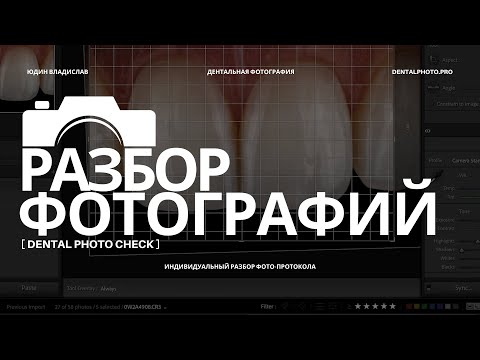 Видео: Dental Photo Check #1 | Разбор дентальных фотографий из зуботехнической лаборатории