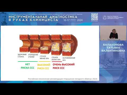 Видео: Новая система стратификации риска инсульта - возможности Plaque-RADS