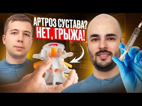Видео: РЕДКАЯ ГРЫЖА В ПОЯСНИЦЕ | Резорбция и лечение!