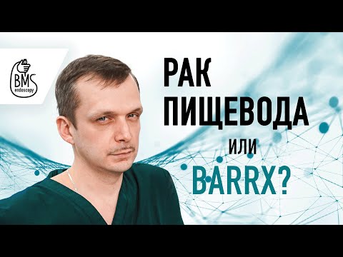 Видео: Рак пищевода или Barrx? Пищевод Барретта: представление и возможности лечения #ракпищевода