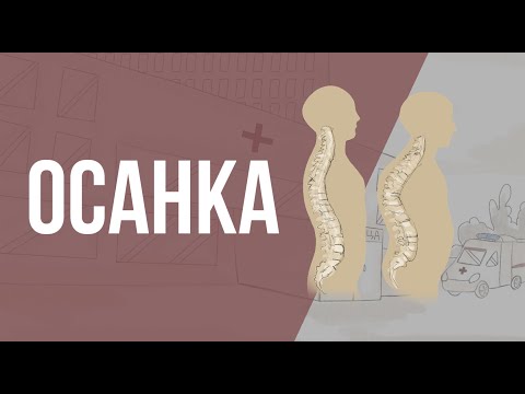 Видео: Что такое осанка? Типы осанки.  Коррекция осанки