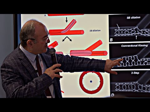 Видео: Биодеградируемые каркасы. А.М.Бабунашвили