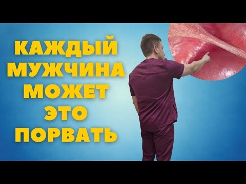 Видео: Уздечка полового органа // Что это? И почему столько бед от неё
