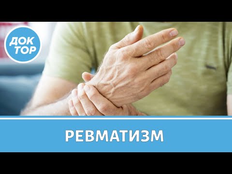 Видео: Врач–ревматолог рассказал, как обнаружить ревматизм вовремя