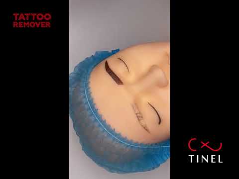 Видео: Удаление татуажа. Ремувер TINEL TATTOO REMOVER