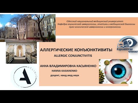 Видео: Аллергические конъюнктивиты