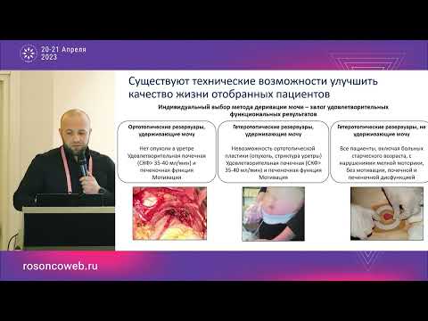 Видео: Цистэктомия – краеугольный камень успеха!