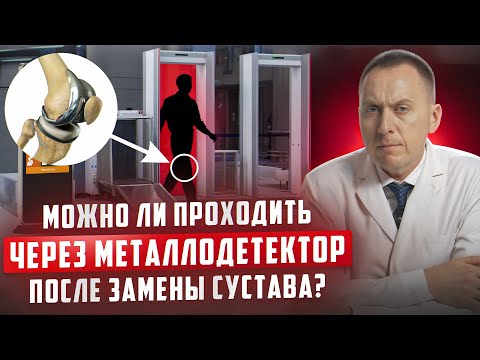 Видео: Можно ли проходить через металлодетектор после замены коленного сустава?