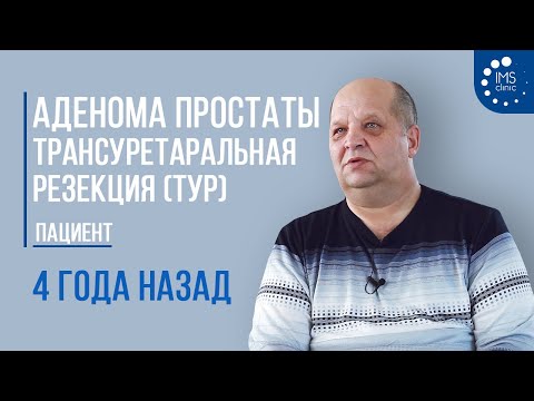 Видео: Аденома простаты. ТУР простаты (Трансуретральная резекция) 4 года назад