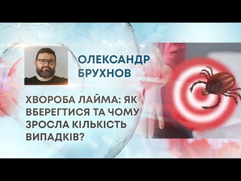 Видео: ТВ7+. ХВОРОБА ЛАЙМА: ЯК ВБЕРЕГТИСЯ ТА ЧОМУ ЗРОСЛА КІЛЬКІСТЬ ВИПАДКІВ?