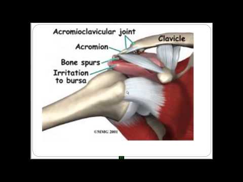 Видео: Плечевой сустав. Строение, функционирование, проблемы, решения