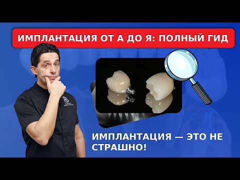 Видео: Имплантация — это НЕ СТРАШНО! Пошаговый разбор всей процедуры от анестезии до фиксации коронки.