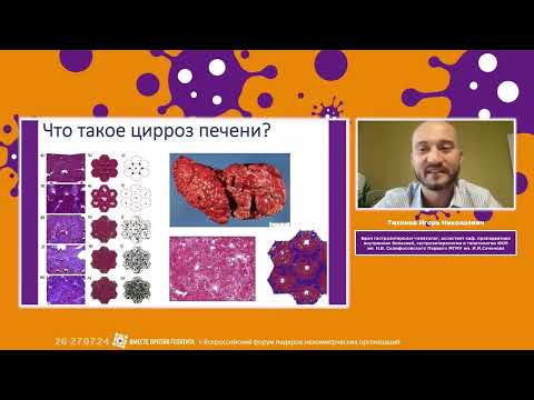 Видео: ТИХОНОВ И. Н. Цирроз печени в исходе хронического вирусного гепатита: современные тренды терапии
