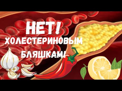 Видео: Правильный способ употребления чеснока и рецепт снижения уровня холестерина в крови.