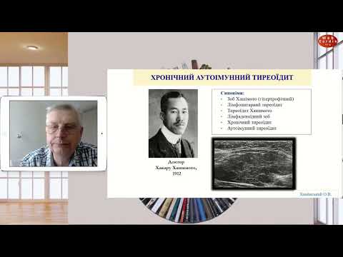 Видео: Аутоімунні захворювання щитоподібної залози. Олексій Камінський