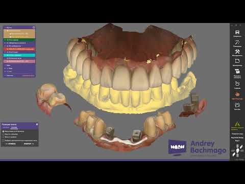 Видео: понедельничный exo-лайфхак №9 - склейка фрагментов и создание из них цельного скана