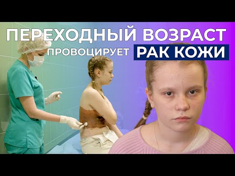 Видео: МЕЛАНОФОРМНЫЙ НЕВУС ТУЛОВИЩА I История Даши Бурдиной