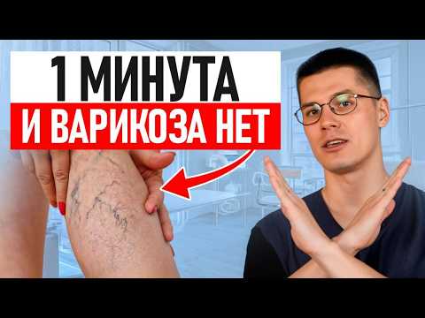 Видео: СЕКРЕТ, который скрывают врачи! / ЛУЧШЕЕ упражнение против ВАРИКОЗА!
