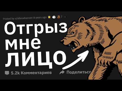 Видео: На Меня Напал Медведь (+Фото). Задавайте вопросы.