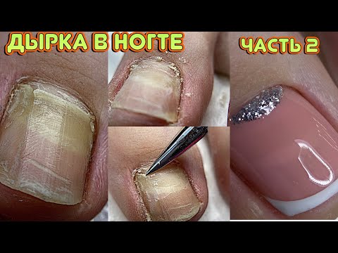 Видео: ДЫРКА в ногте ч2 😕 Ноготь сходит / Гель лаки AN / Педикюр / Френч