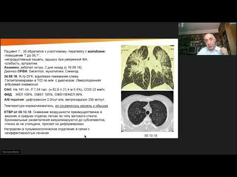 Видео: Вебинар "Гиперчувствительный пневмонит"