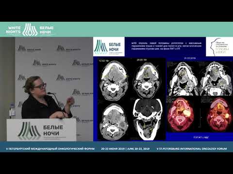 Видео: Возможности КТ и МРТ в диагностике рецидивов злокач. опухолей головы и шеи (Дронова Е.Л.)