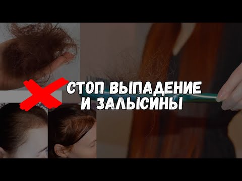 Видео: Выпадают волосы, что делать? Причины выпадения волос и появления залысин. Как с ними справиться?