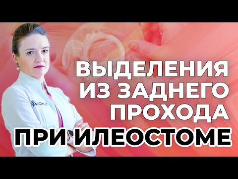 Видео: Выделения из заднего прохода при илеостоме.