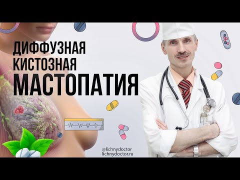 Видео: Диффузная кистозная мастопатия: симптомы, лечение и рекомендации