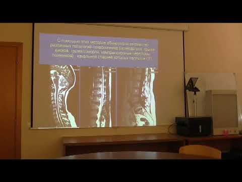 Видео: Лекция Остеохондроз позвоночника