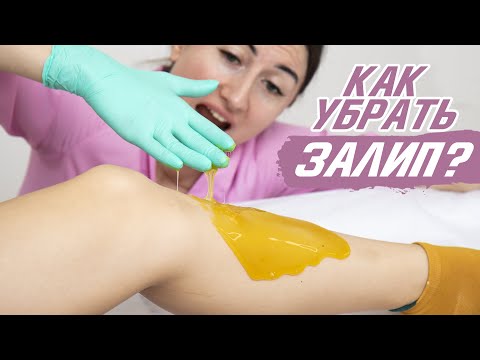 Видео: Как убрать залип при шугаринге? Самые эффективные методы по выходу из залипа!