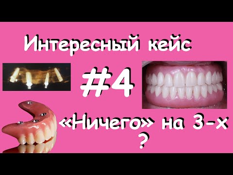 Видео: Ничего на 3-х ??? Интересный кейс #4.