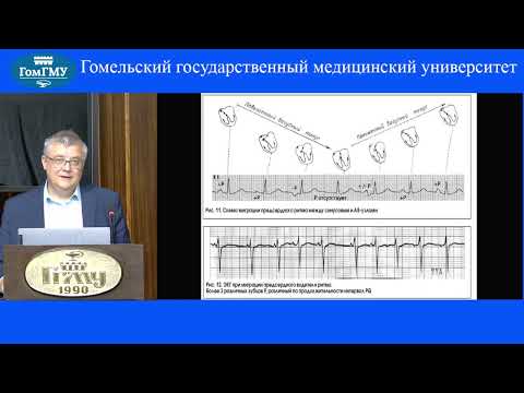 Видео: Саливочик Д.П. пассивные эктопические комплексы и ритмы. АВ-диссоциация.