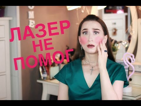 Видео: Все о розацеа 😱 Мой опыт лечения мази и БАДы 💥 iHerb