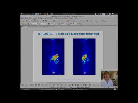 Видео: Питание и детокс при химиотерапии и облучении