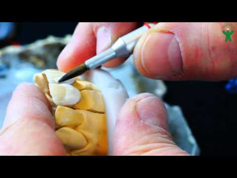 Видео: Cercon Duceram LOVE + 4 этап