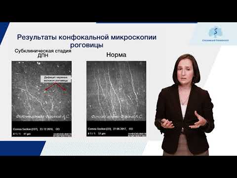 Видео: Диабетическая нейропатия и ее роль в развитии Синдрома Диабетической Стопы.