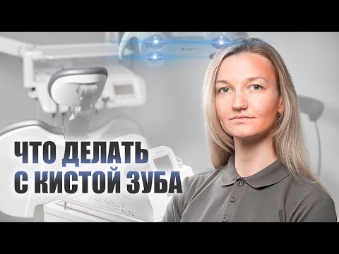 Видео: 🇺🇦 Киста зуба, лечение кисты зуба