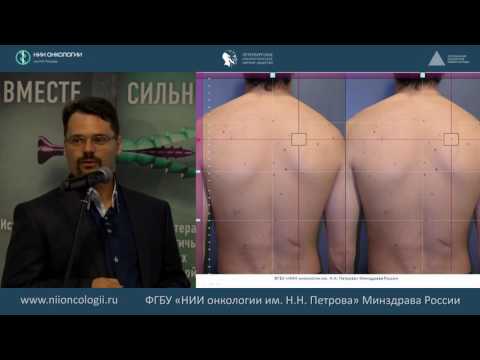 Видео: Меланома: общие сведения, эпидемиология