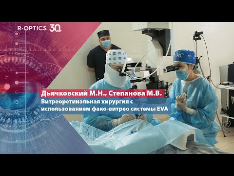 Видео: Витреоретинальная хирургия с использованием фако-витрео системы EVA (Дьячковский М.Н.)