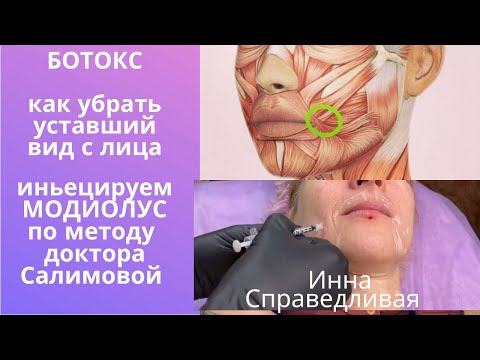 Видео: Как убрать уставший вид с лица. Инъецируем мышцу МОДИОЛУС по методу доктора Салимовой.