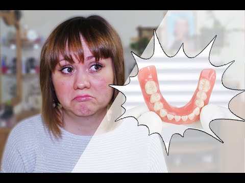 Видео: 22. Dentures/Съемные зубные протезы: 3 года спустя