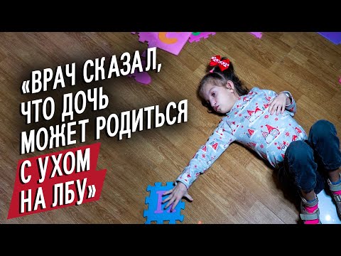 Видео: У моей дочери синдром Вольфа-Хиршхорна: Елена | Быть мамой