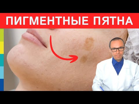 Видео: Этот ДЕФИЦИТ вызывает Возрастные Пигментные Пятна! ✍️
