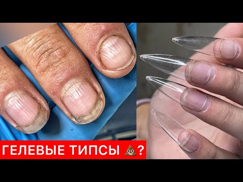 Видео: МОЕ МНЕНИЕ О ГЕЛЕВЫХ ТИПСАХ
