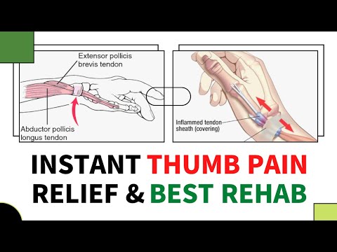 Видео: Упражнения от теносиновита де Кервена! обезболивающее запястье