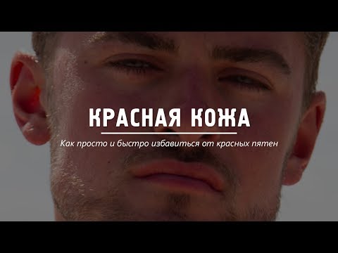 Видео: Как избавиться от красных пятен за 5 минут