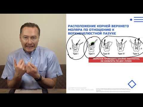 Видео: Модуль 3  Урок 2   Атравматичное удаление моляров верхней челюсти